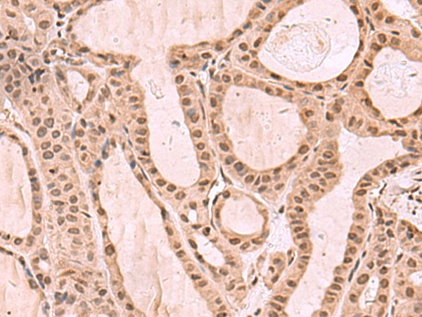 KDM7A Polyclonal Antibody (E-AB-52053)