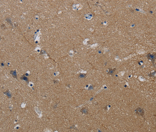 PIK3CG Polyclonal Antibody (E-AB-13516)