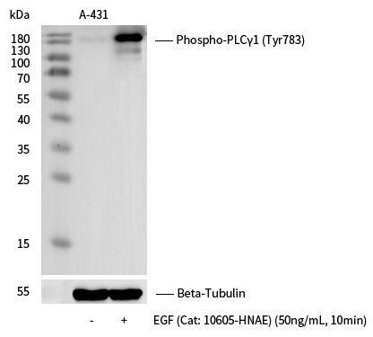 Recombinant Phospho-PLCγ1 (Tyr783) Monoclonal Antibody (AN300148L)