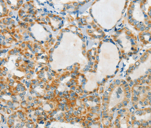 AANAT Polyclonal Antibody (E-AB-14757)
