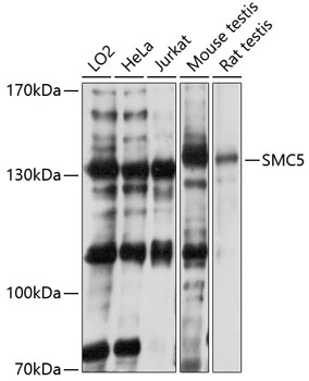 SMC5 Polyclonal Antibody (E-AB-92465)