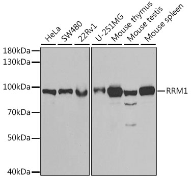 RRM1 Polyclonal Antibody (E-AB-64573)
