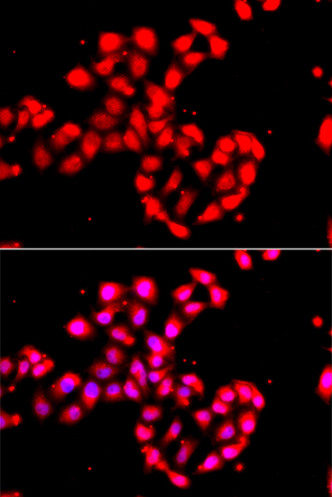 CAMK1D Polyclonal Antibody (E-AB-64636)