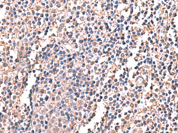 LDHAL6B Polyclonal Antibody (E-AB-52924)