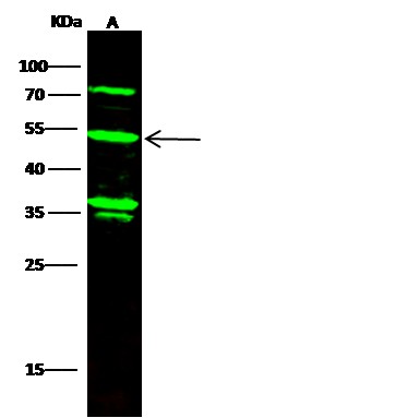 Recombinant KYNU Monoclonal Antibody (AN300506P)