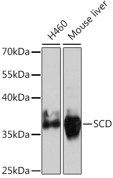 (KO Validated) SCD Polyclonal Antibody (E-AB-66816)