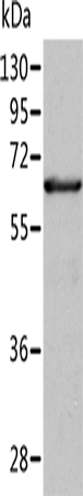 ALDH4A1 Polyclonal Antibody (E-AB-14536)