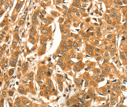DIRAS1 Polyclonal Antibody (E-AB-13199)