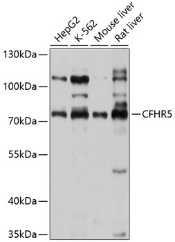 CFHR5 Polyclonal Antibody (E-AB-90143)