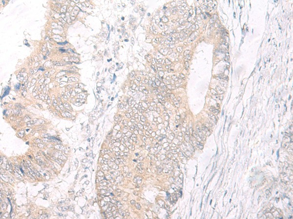 IL17A Polyclonal Antibody (E-AB-17917)