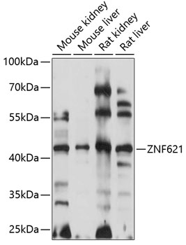 ZNF621 Polyclonal Antibody (E-AB-90914)