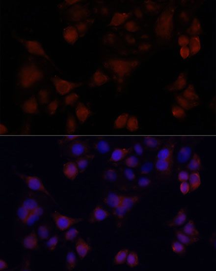 MAPRE1 Polyclonal Antibody (E-AB-63725)
