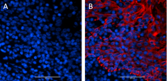 Alexa Fluor® 594 anti-Pan-Cytokeratin Antibody (914205)