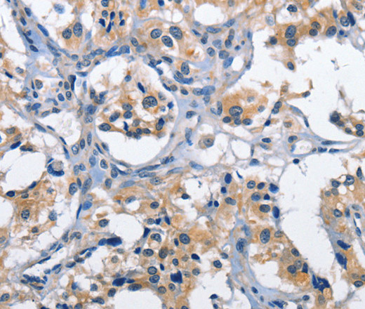 CLEC2D Polyclonal Antibody (E-AB-14005)