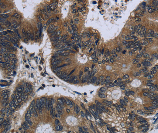 GK1 Polyclonal Antibody (E-AB-15076)