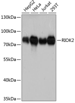 RIOK2 Polyclonal Antibody (E-AB-63629)