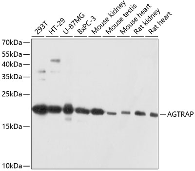 AGTRAP Polyclonal Antibody (E-AB-63651)