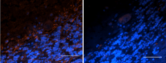 Purified anti-Oligodendrocyte Marker O1 Antibody (607751)