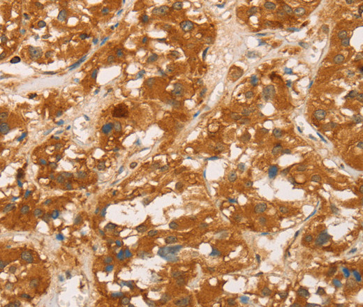 CD43 Polyclonal Antibody (E-AB-11060)