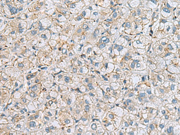 MTHFD2 Polyclonal Antibody (E-AB-19239)