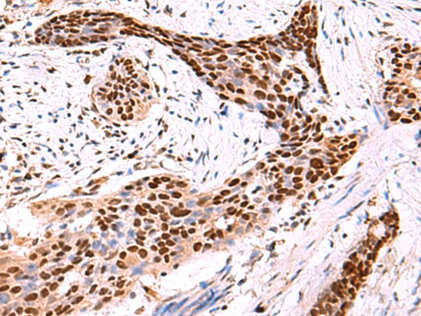SOX2 Polyclonal Antibody (E-AB-52071)