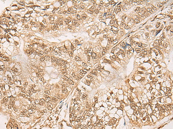 WEE1 Polyclonal Antibody (E-AB-19363)
