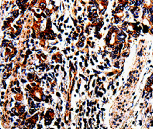 ACSBG2 Polyclonal Antibody (E-AB-13784)