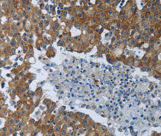 EIF2AK2 Polyclonal Antibody (E-AB-16039)