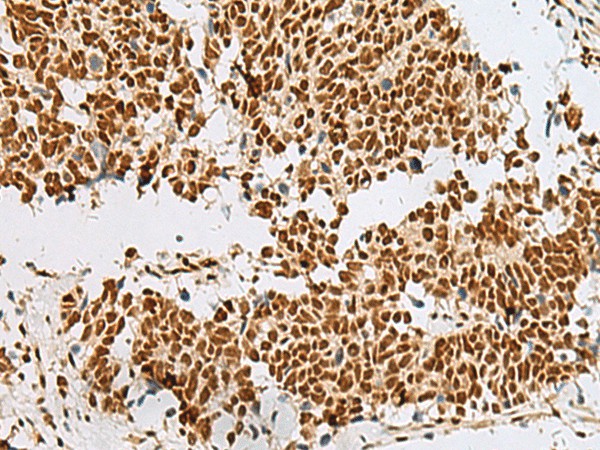 RBM12 Polyclonal Antibody (E-AB-52782)