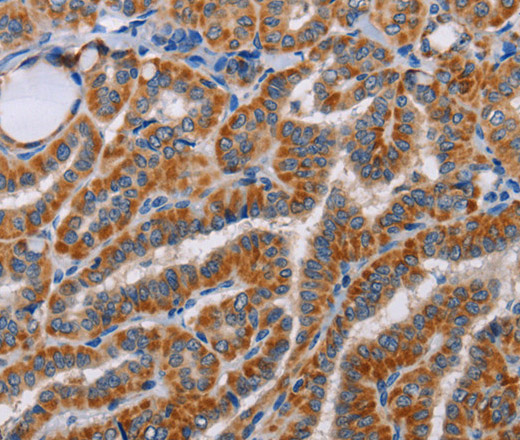 ALG9 Polyclonal Antibody (E-AB-10773)