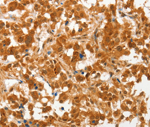 COL4A3BP Polyclonal Antibody (E-AB-14885)