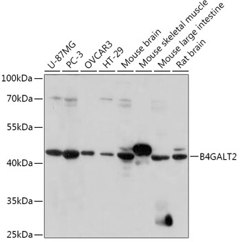 B4GALT2 Polyclonal Antibody (E-AB-91819)