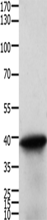 TPM2 Polyclonal Antibody (E-AB-12435)