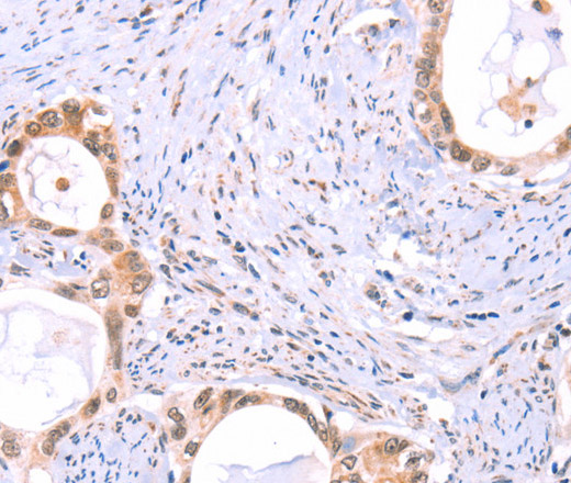 PROS1 Polyclonal Antibody (E-AB-10681)