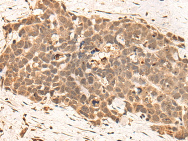 CLK2 Polyclonal Antibody (E-AB-53303)