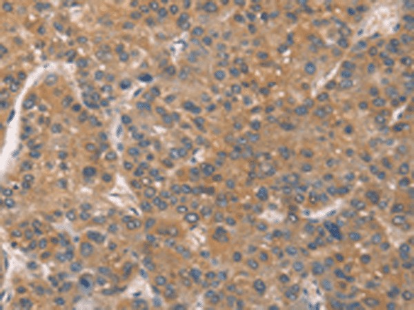 ZADH2 Polyclonal Antibody (E-AB-53215)