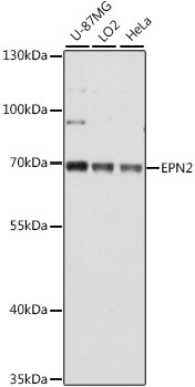 EPN2 Polyclonal Antibody (E-AB-66691)