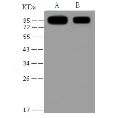 Anti-SARS-CoV Spike S1 Monoclonal Antibody (E-AB-V1350)