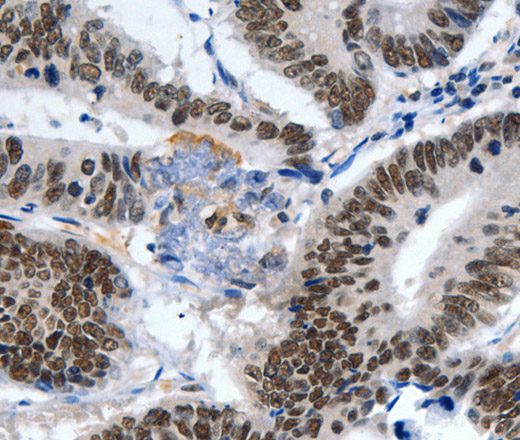 LRP5 Polyclonal Antibody (E-AB-12546)
