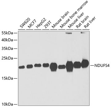 NDUFS4 Polyclonal Antibody (E-AB-61925)