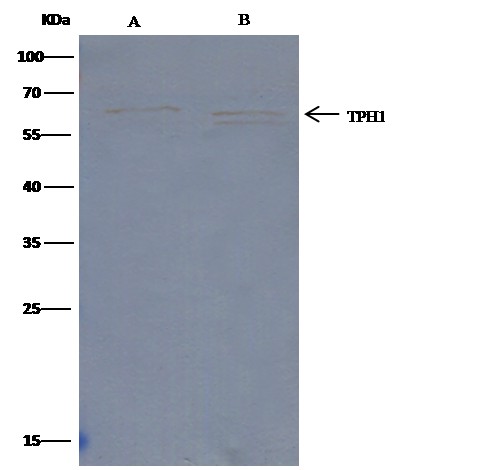Recombinant Tryptophan Hydroxylase 1/TPH1 Monoclonal Antibody (AN300408P)