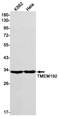 Recombinant Transmembrane Protein 192 Monoclonal Antibody (E-AB-81616)