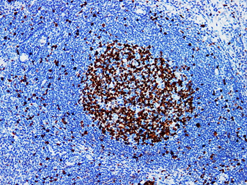 Ki-67 Monoclonal Antibody (ELAB6189-M)