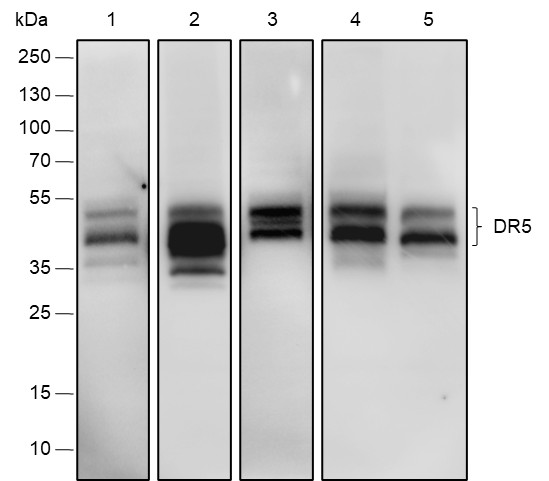 Recombinant DR5 Monoclonal Antibody (AN301856L)