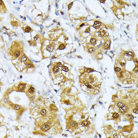 RRAGD Polyclonal Antibody (E-AB-63156)