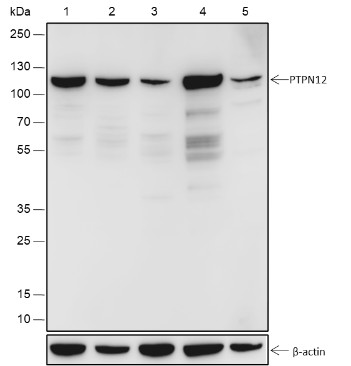 Recombinant PTPN12 Monoclonal Antibody (AN301790L)