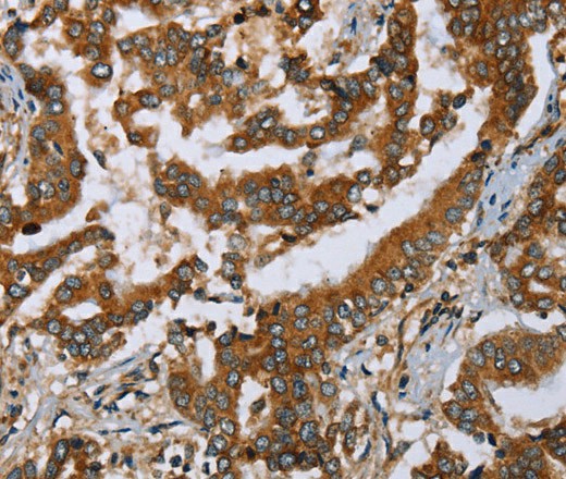 PLXNB1 Polyclonal Antibody (E-AB-16723)