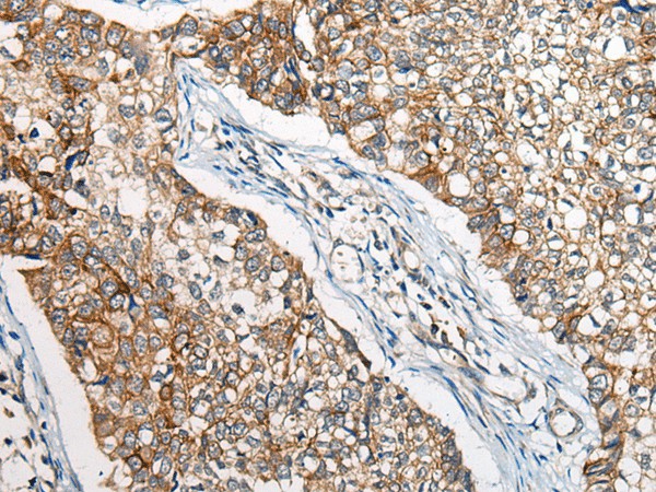 BBS12 Polyclonal Antibody (E-AB-53593)