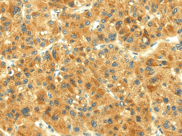 THAP3 Polyclonal Antibody (E-AB-17446)
