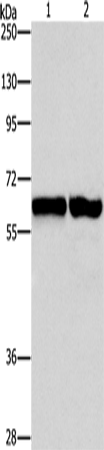ASNS Polyclonal Antibody (E-AB-10967)